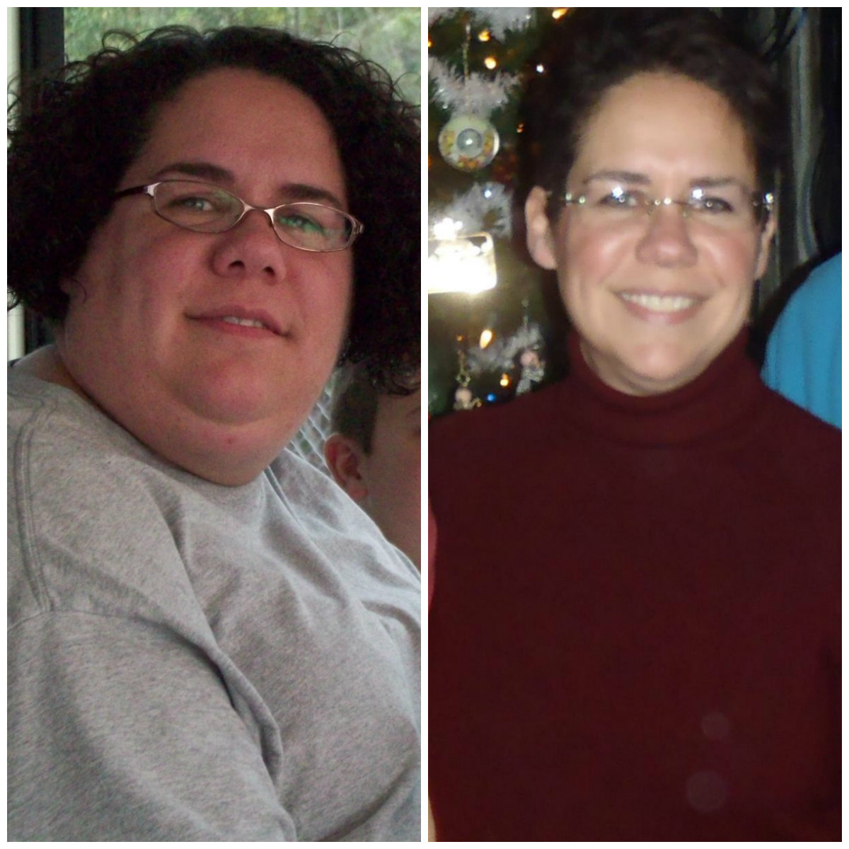 http://www.beliteweight.com/blog/wp-content/uploads/2013/02/Marlee-Before-and-After-Gastric-Sleeve-Surgery.jpg