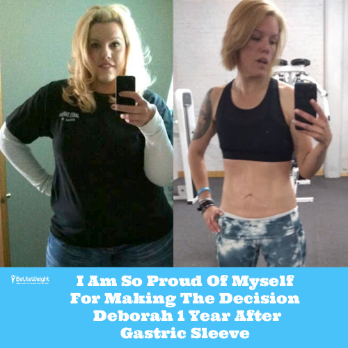I Am So Proud Of Myself For Making The Decision - Deborah 1 Year After  Gastric Sleeve - BeLiteWeight
