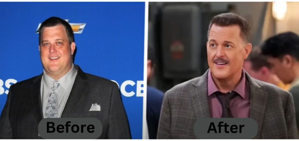 Billy Gardell Weight Loss Before and After Photos