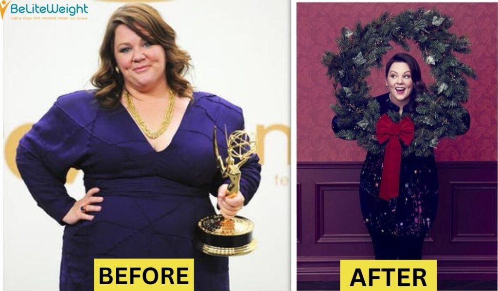 Melissa mccarth Before and After photos